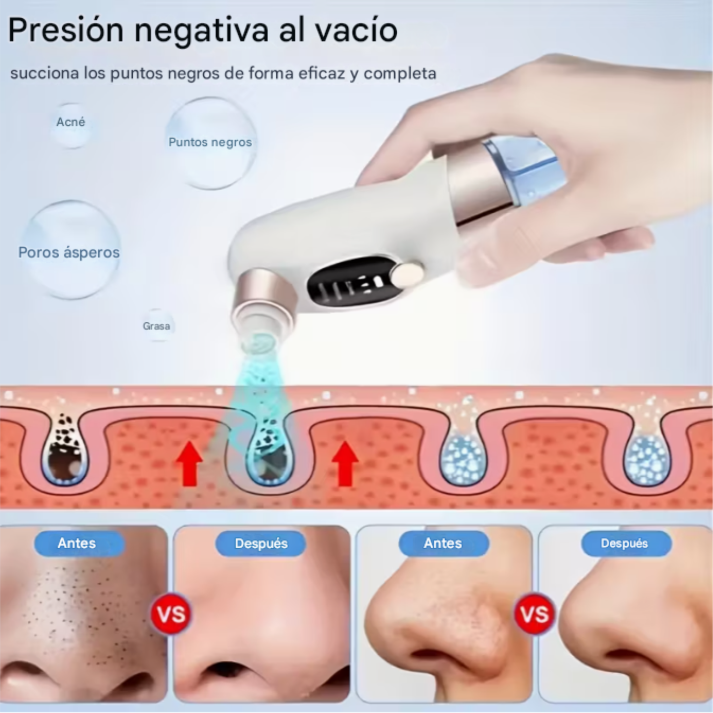 Máquina Eléctrica para Eliminar Puntos Negros