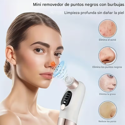 Máquina Eléctrica para Eliminar Puntos Negros