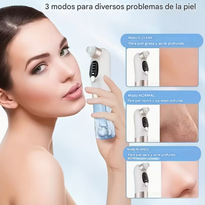 Máquina Eléctrica para Eliminar Puntos Negros